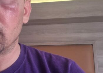 AGGREDITO ALLA STAZIONE DI MILANO LAMBRATE: IL RACCONTO DI LUCA PETRANGELO